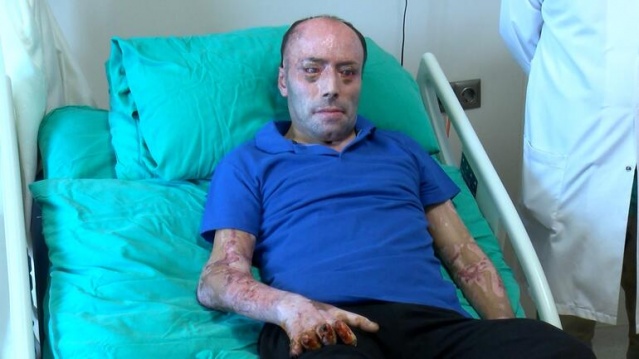 Amasra Maden Faciasından 8 Ay Sonra Taburcu Edildi